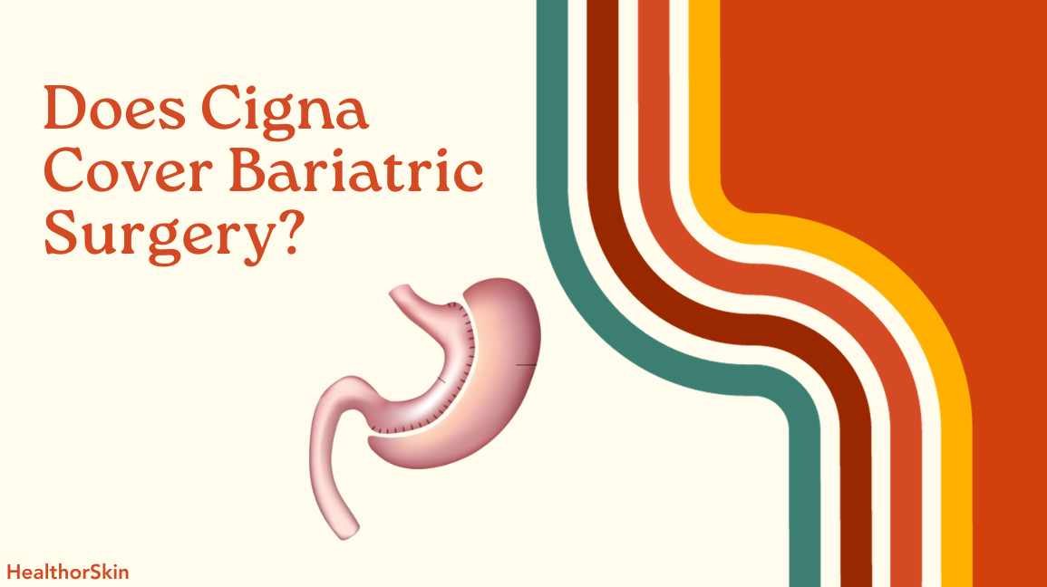 Does Cigna Cover Bariatric Surgery