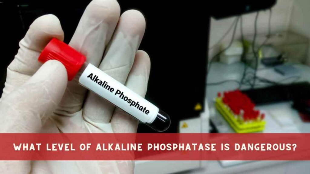 what-level-of-alkaline-phosphatase-is-dangerous-complete-guide