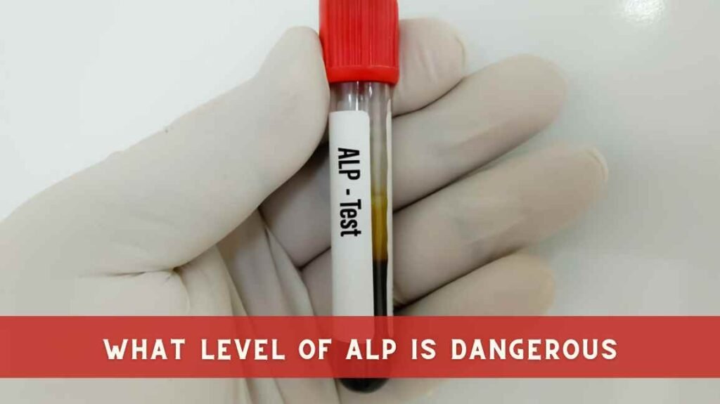 what level of alp is dangerous