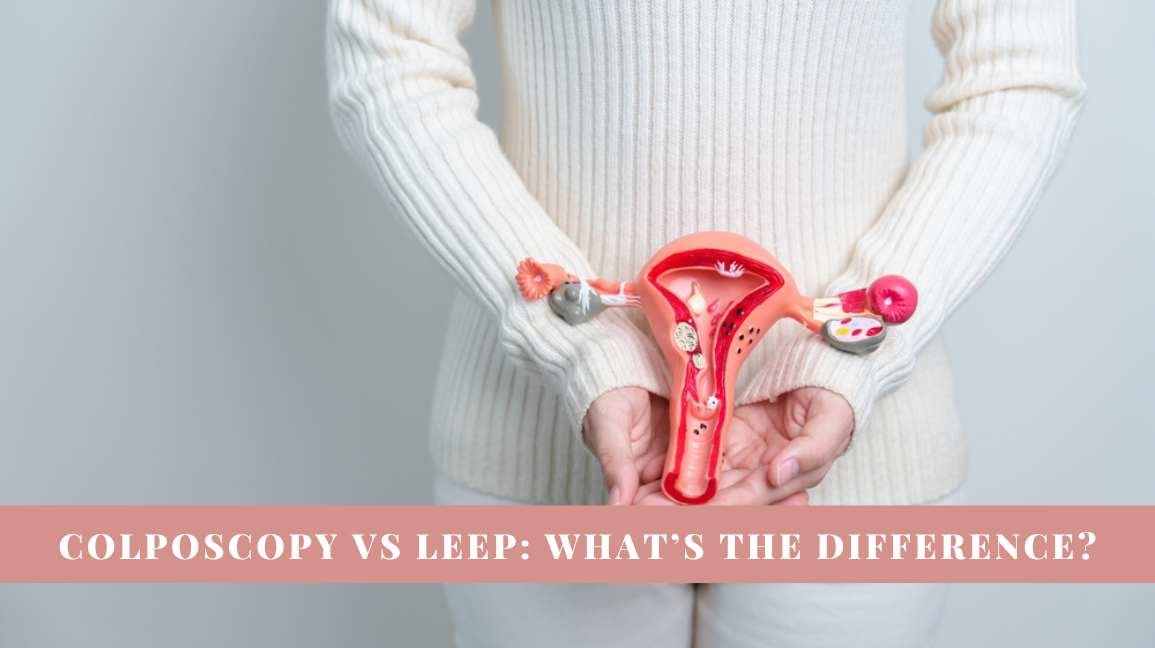 Colposcopy vs LEEP