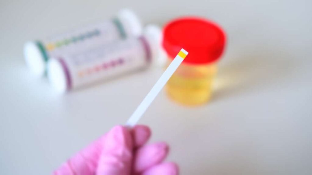 What Is the FM590pp NonDOT Urine Test Used For?