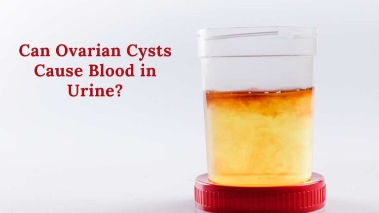 Can Ovarian Cysts Cause Blood in Urine