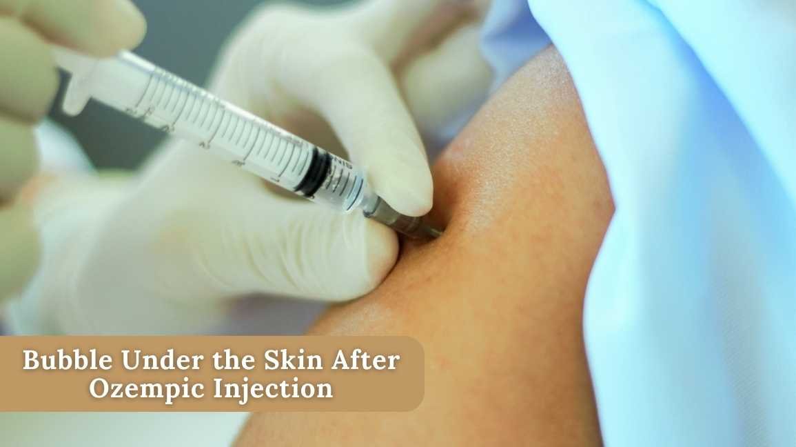 ozempic injection bubble under skin