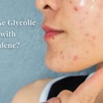 Can you use Glycolic acid with Adapalene