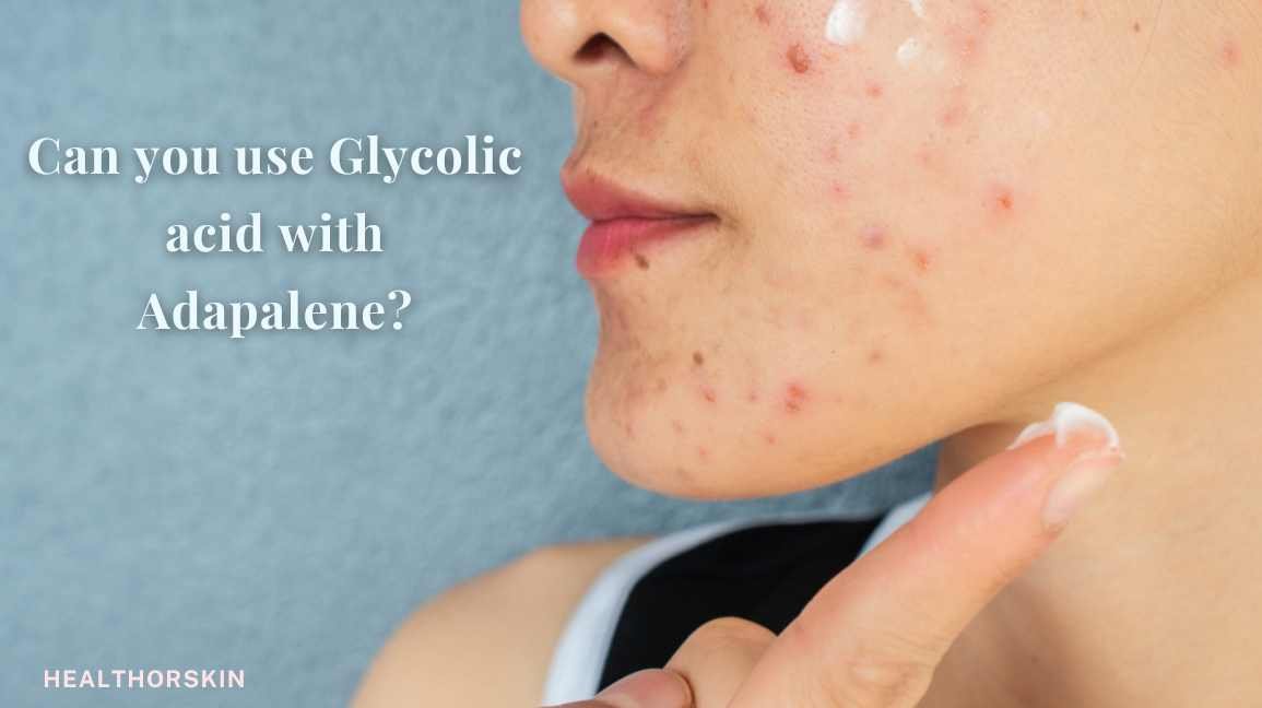 Can you use Glycolic acid with Adapalene