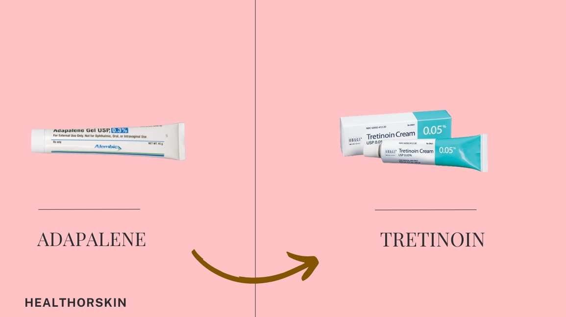 Switching From Adapalene to Tretinoin