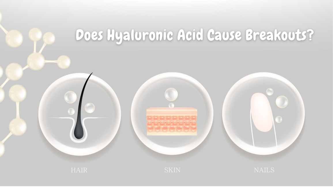 Does Hyaluronic Acid Cause Breakouts